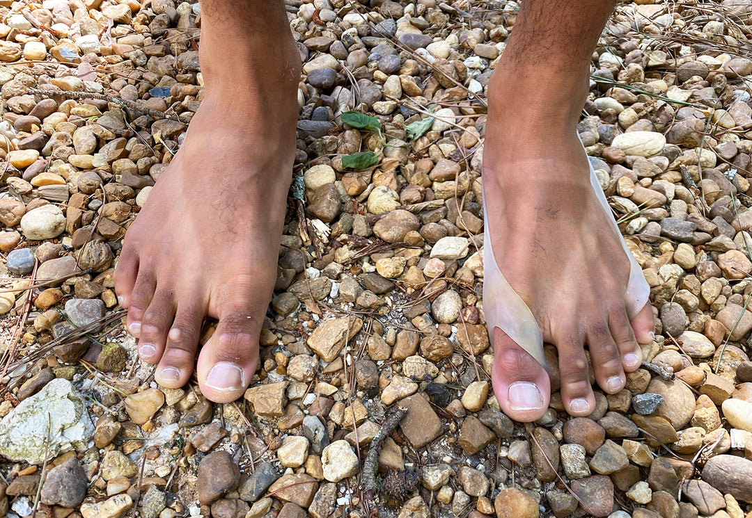 Toe Expanders | Bunion Relief & Natural Toe Alignment – Earth Runners ...